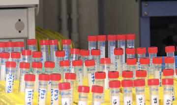 Coronavirus: dal bollettino di domenica 25 aprile 2021