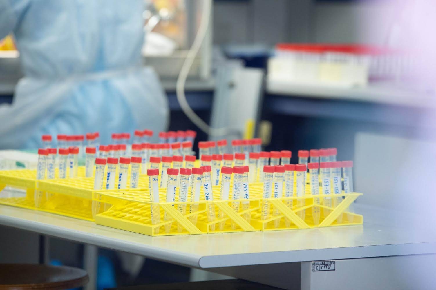 Immagine: 544AF25D-AB7D-4255-BCEB-F89BD13898E6