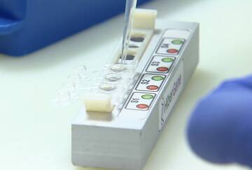 Coronavirus: dal bollettino di domenica 28 febbraio 