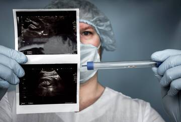 Nuove tecnologie laser per curare la calcolosi urinaria 