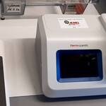 Immagine: Donazione admo a laboratorio tipizzazione hla 2