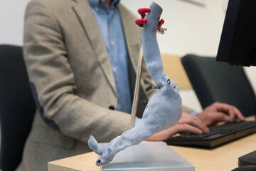 Intervento all’aorta: con la stampa 3D si pianifica meglio