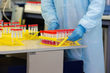 Coronavirus: i dati dal bollettino di venerdì 19 marzo 