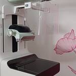 Immagine: Nuovo mammografo AI