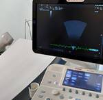 Immagine: Sonda ecografica